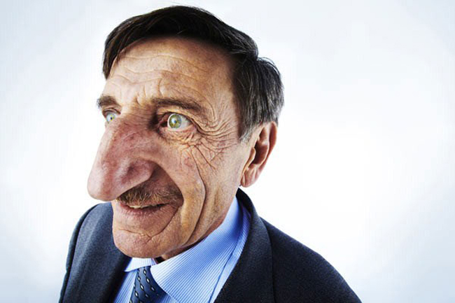 Ông Mehmet Ozyurek, người Thổ Nhĩ Kỳ đang là người có chiếc mũi dài nhất thế giới. Chiếc mũi của ông được đo vào ngày 6/7/2007 có độ dài là 8,8cm. Hiện người đàn ông này đang sinh sống tại Artvin, Thổ Nhĩ Kỳ.